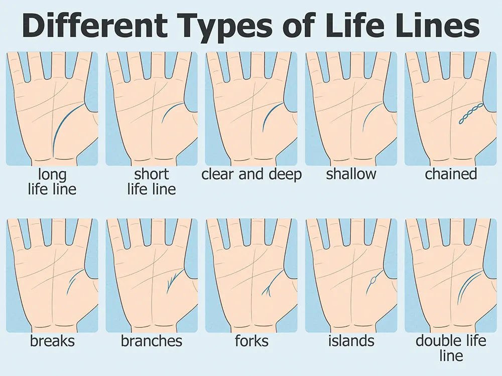 Detailed diagram illustrating the chained life line meaning in palmistry, showing signs of health fluctuations
