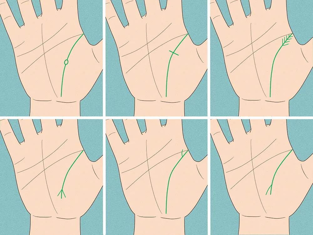 Side-by-side comparison of normal and chained life line in palmistry, illustrating health implications