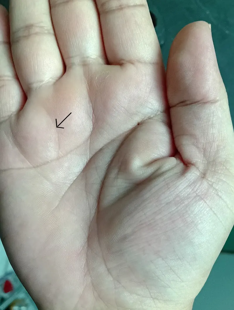 Sun Line in Palmistry: Does It Guarantee Fame and Success? 2 Detailed diagram illustrating the Sun Line in Palmistry along with other major palm lines